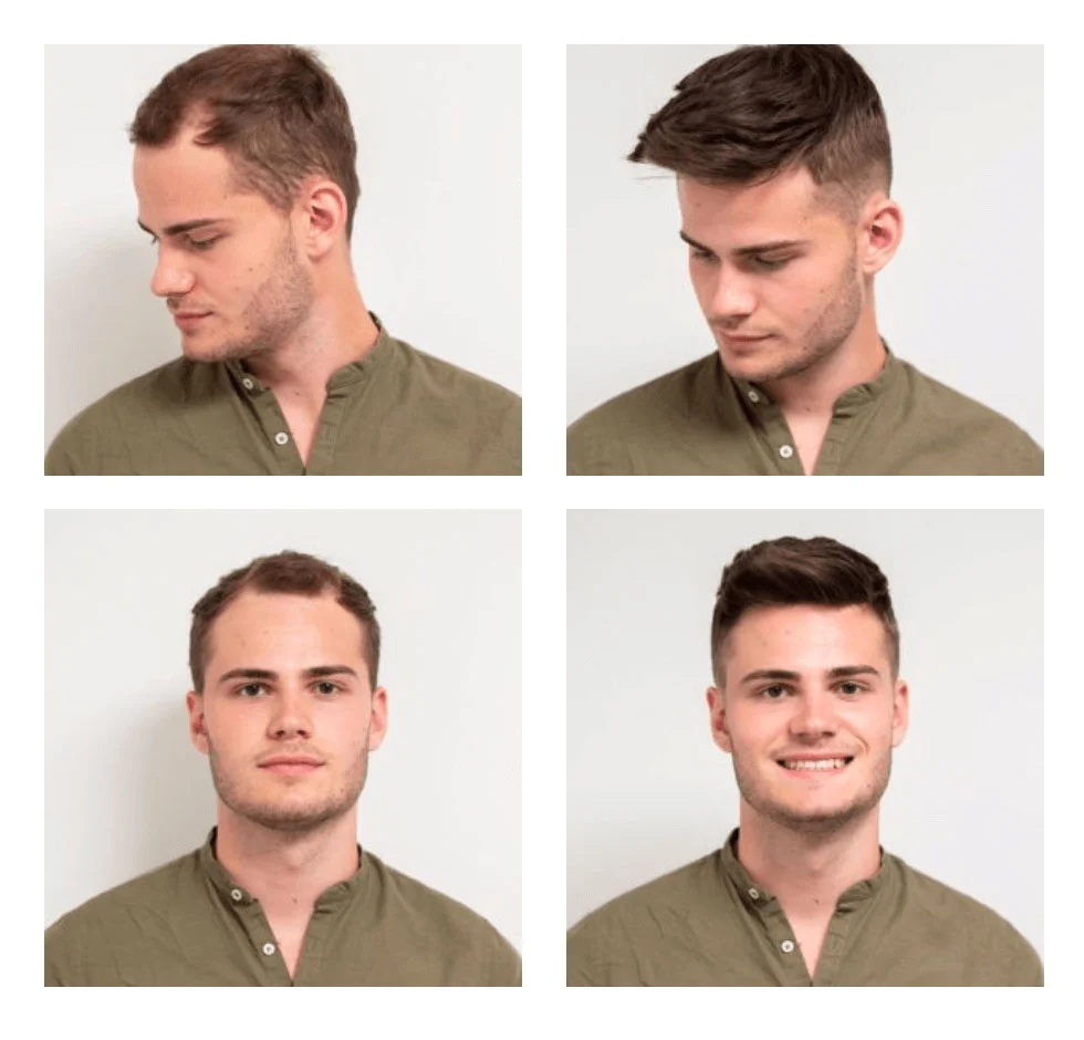 Resultado Santiago — 4 meses con Método PARC