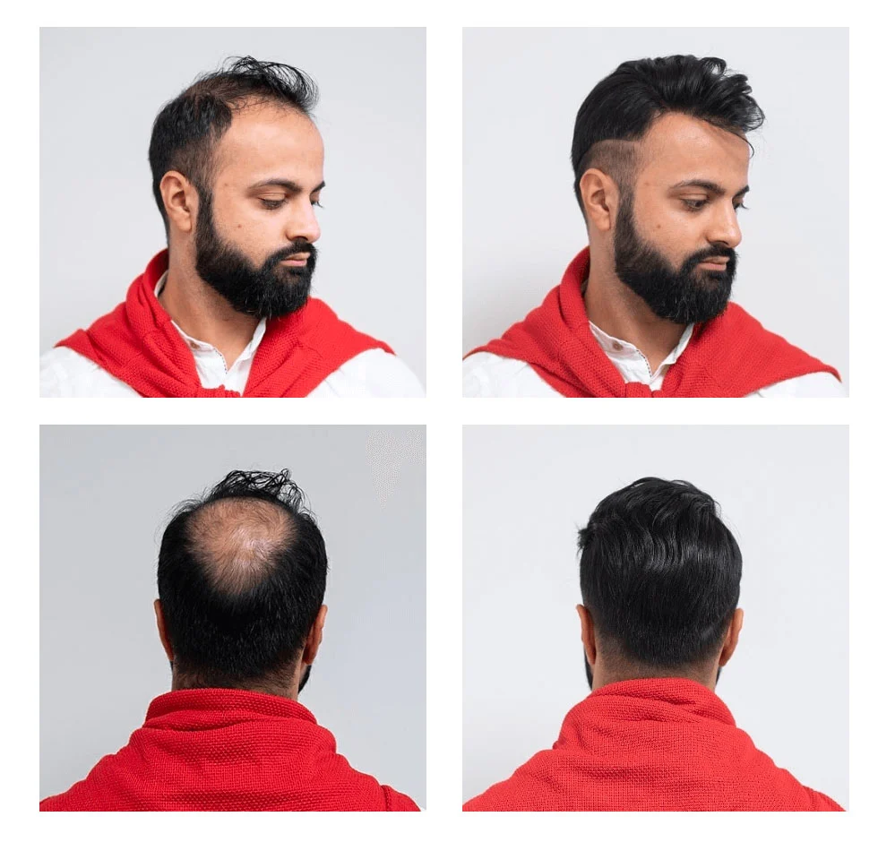 Resultado Mateo — 7 meses con Método PARC